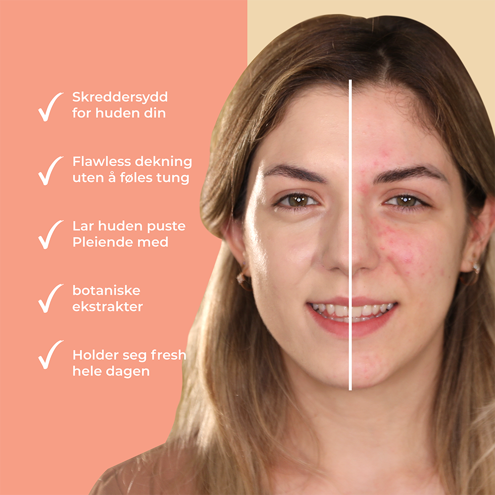 Glow Compact Foundation